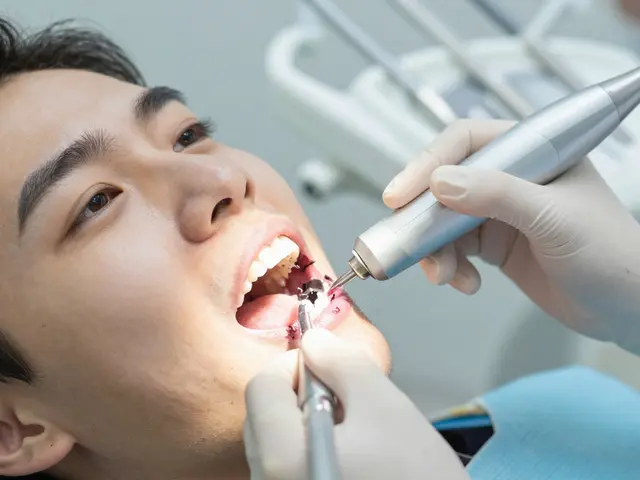 Odstranění zubního kamene: Jak to funguje a co očekávat