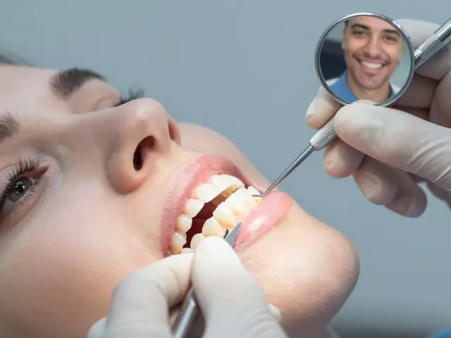 5 mýtů o zubních fasetách, které musíte přestat věřit