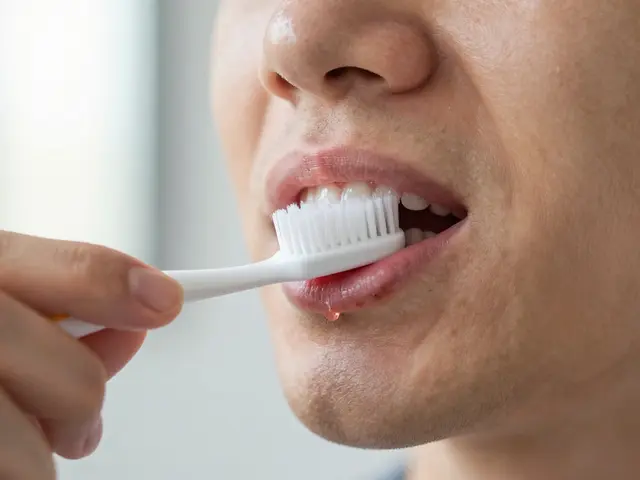 Co na podrážděné dásně? Úplný průvodce léčbou a prevencí zubního kamene