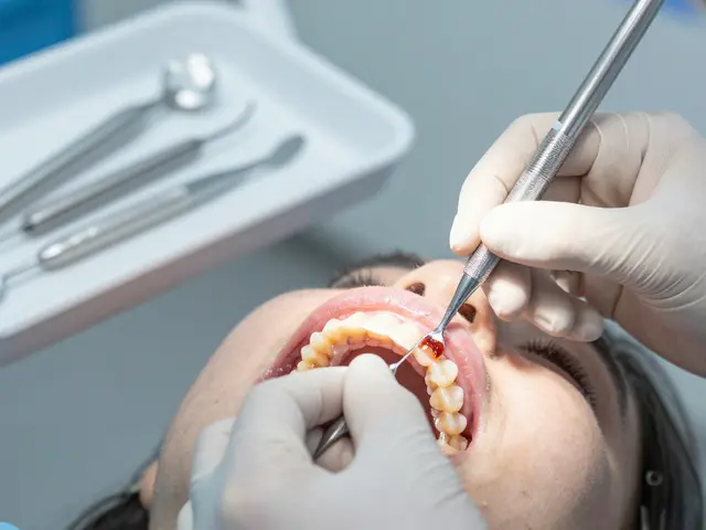 Keramické fazety: Jaké jsou možnosti nahrazení