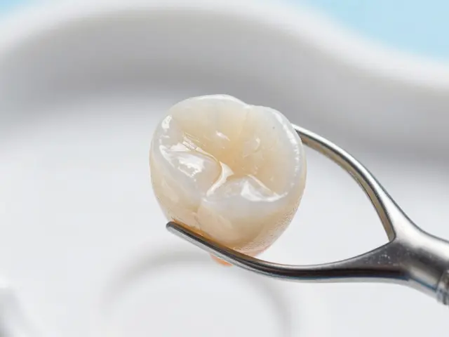 10 nejlepších výhod celokeramických fazet: Proč zvolit keramiku místo kompozitu?