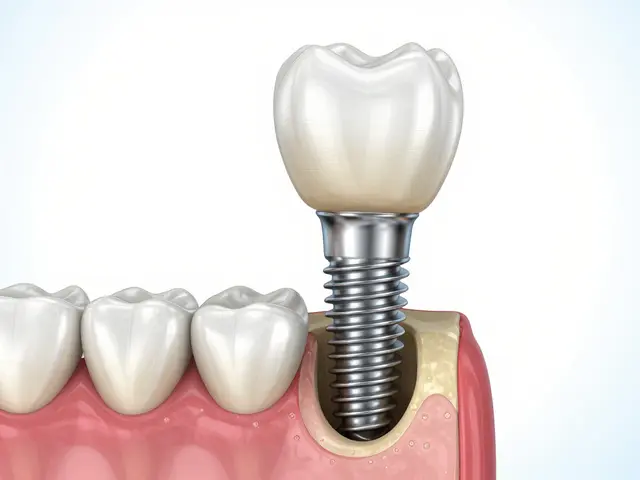 Jak dlouho vydrží zubní implantáty? Pravda o životnosti a péči