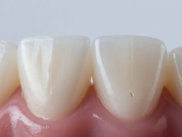 Jak se léčí praskliny na zubech? Přehled metod od bondingu po korunky