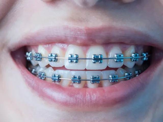 Zničené zuby po rovnátkách: Jak poznat problémy a jak jim předběhnout