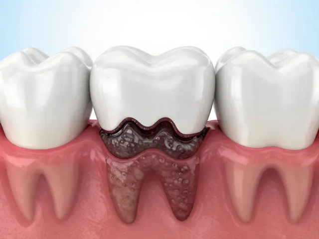 Zubní kámen pod dásní: Neviditelný nepřítel vašich zubů a dásní