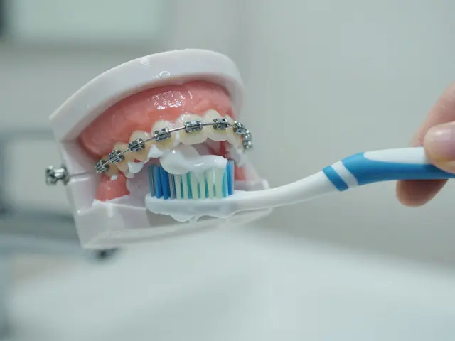Jak dlouho si čistit zuby s rovnátky? Kompletní průvodce péčí o ortodontii