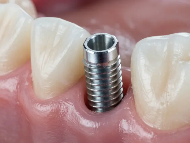 Jak dlouho vydrží zubní implantát? Skutečná životnost, rizika a péče